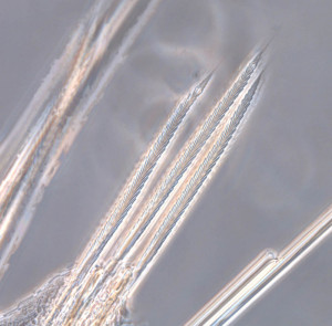 Verticilate chaetae (bristles) from one of the polycirrinae species photographed through a microscope. Photo: MHL