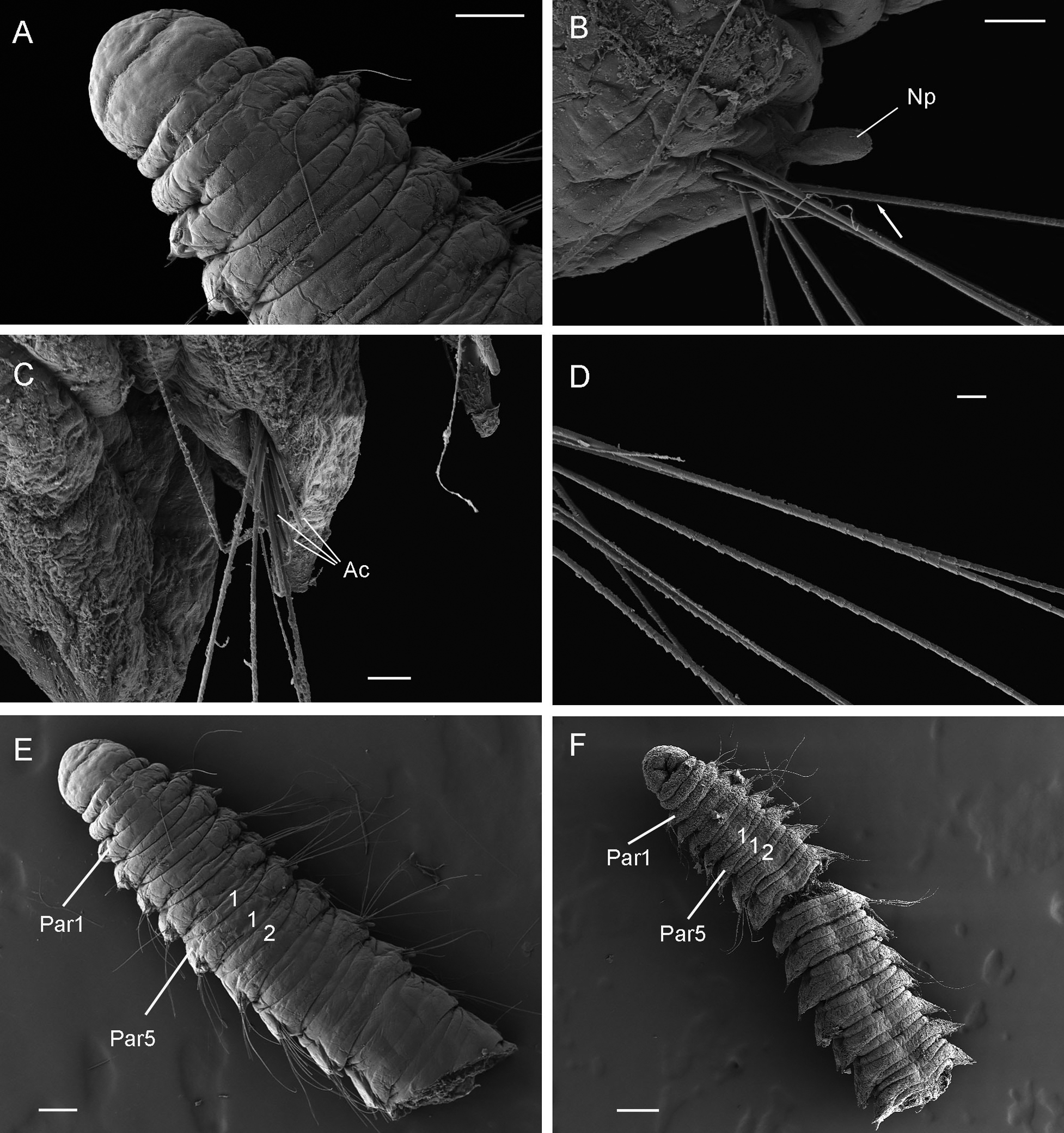 A scientific illustration with B&W SEM images of a small worm